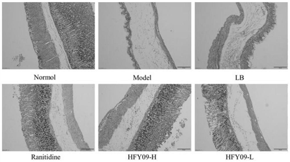 Probiotic and application thereof in gastric injury