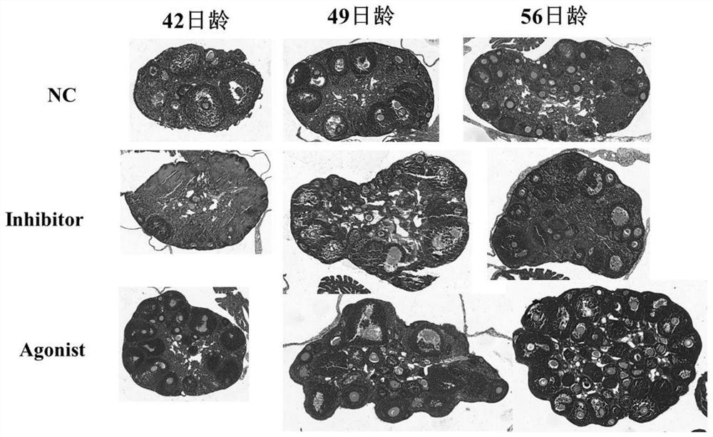 Application of histone methylation H3K4me3 in mouse ovarian development