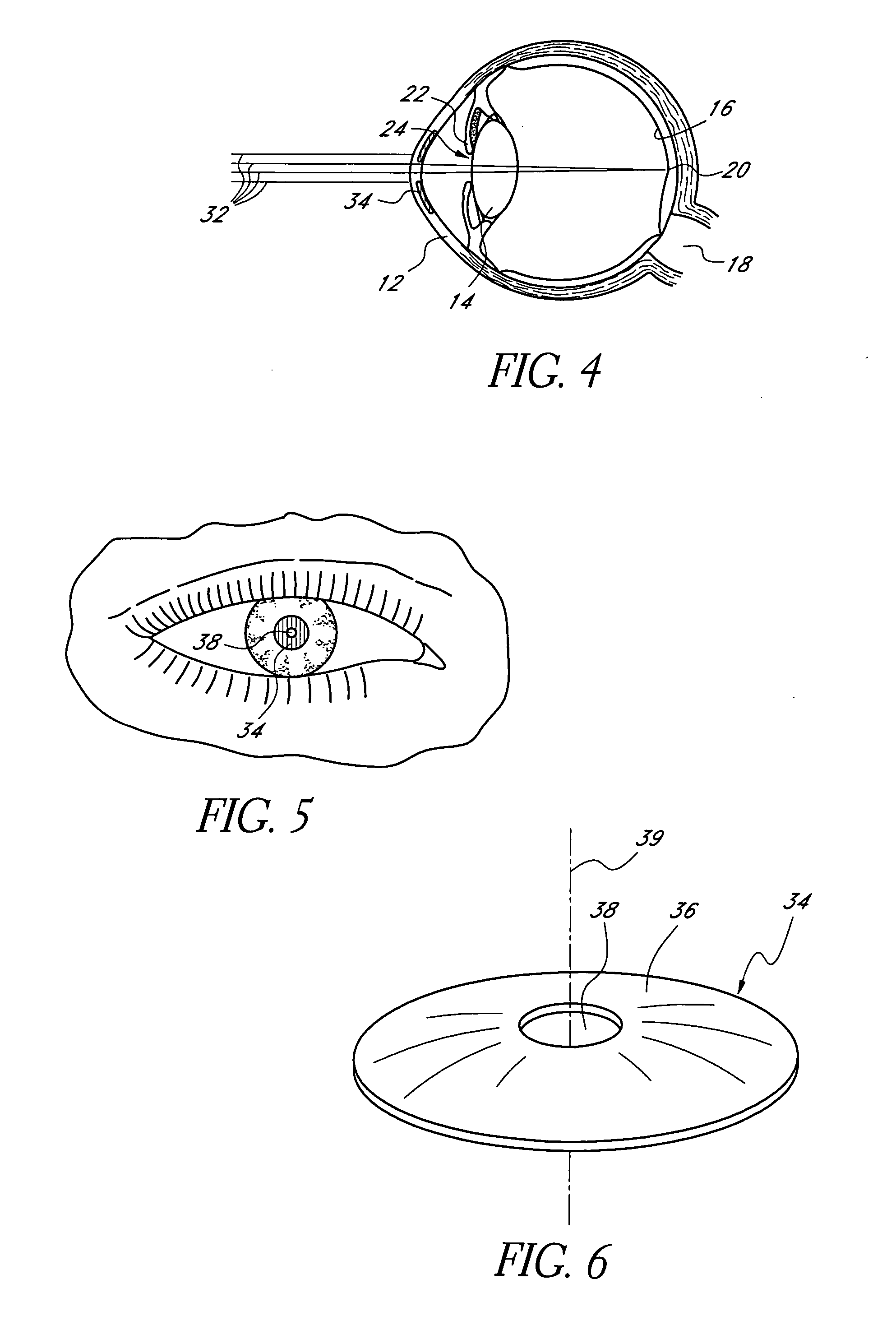 Corneal mask formed of degradation resistant polymer and providing reduced corneal deposits