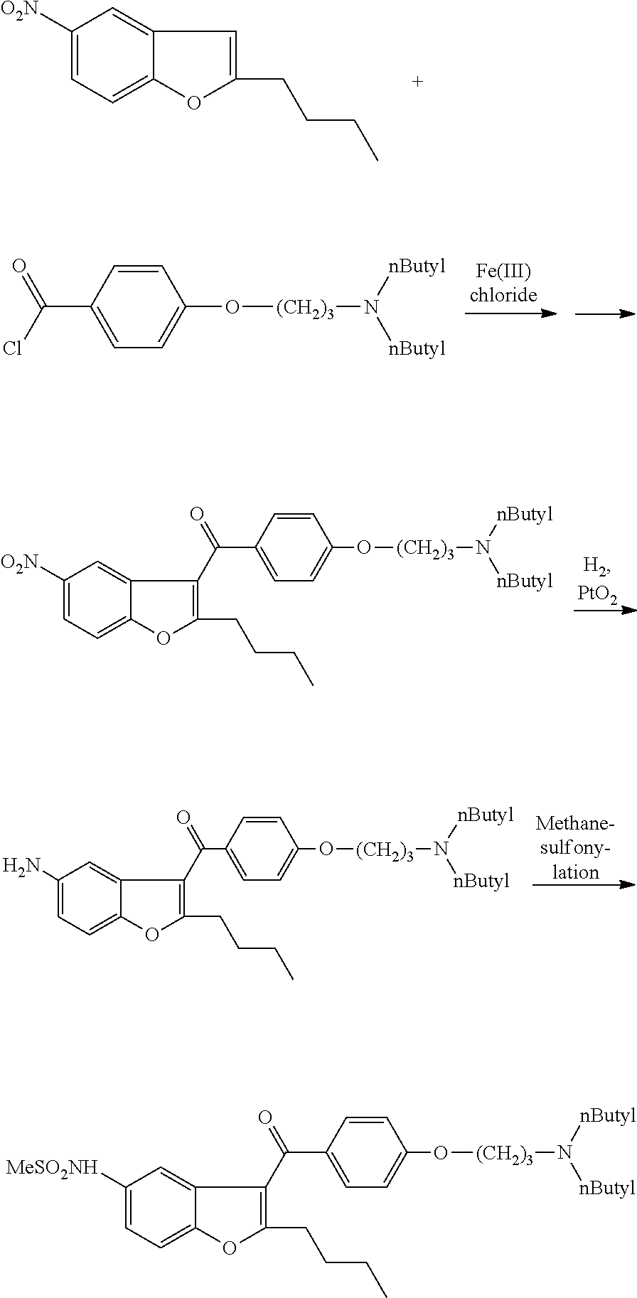 Process for preparation of dronedarone by removal of hydroxyl group