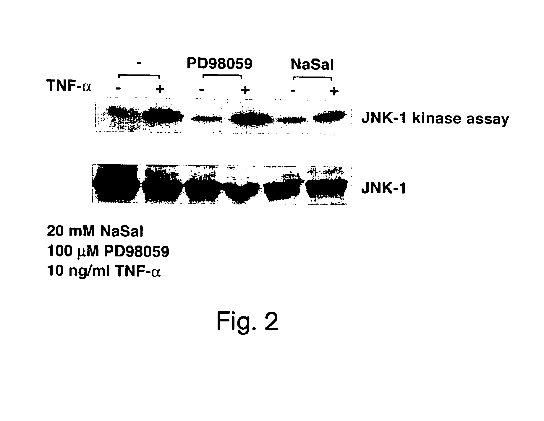 Methods for treating and preventing insulin resistance and related disorders