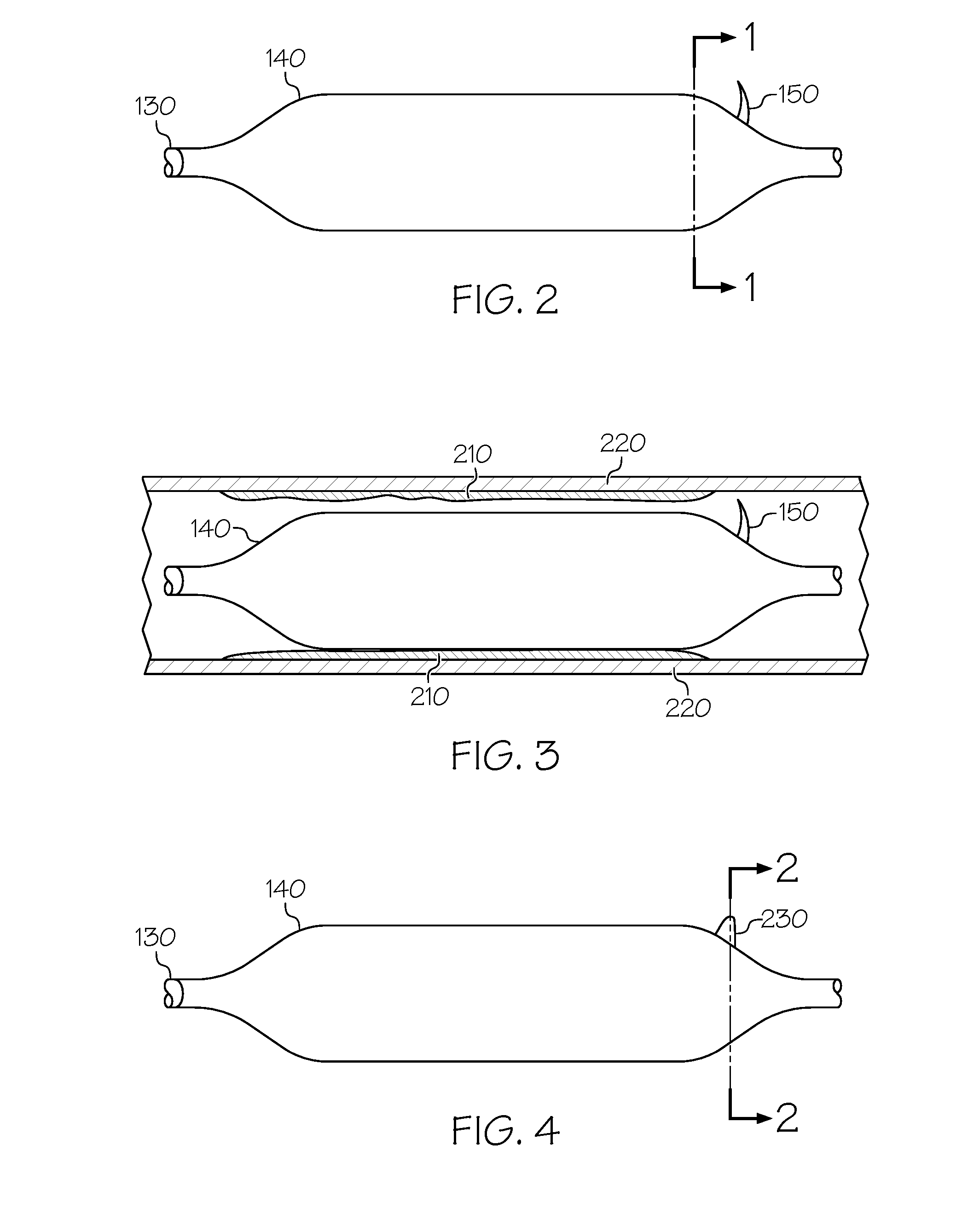 Intravascular catheter balloon device having a tool for atherectomy or an incising portion for atheromatous plaque scoring