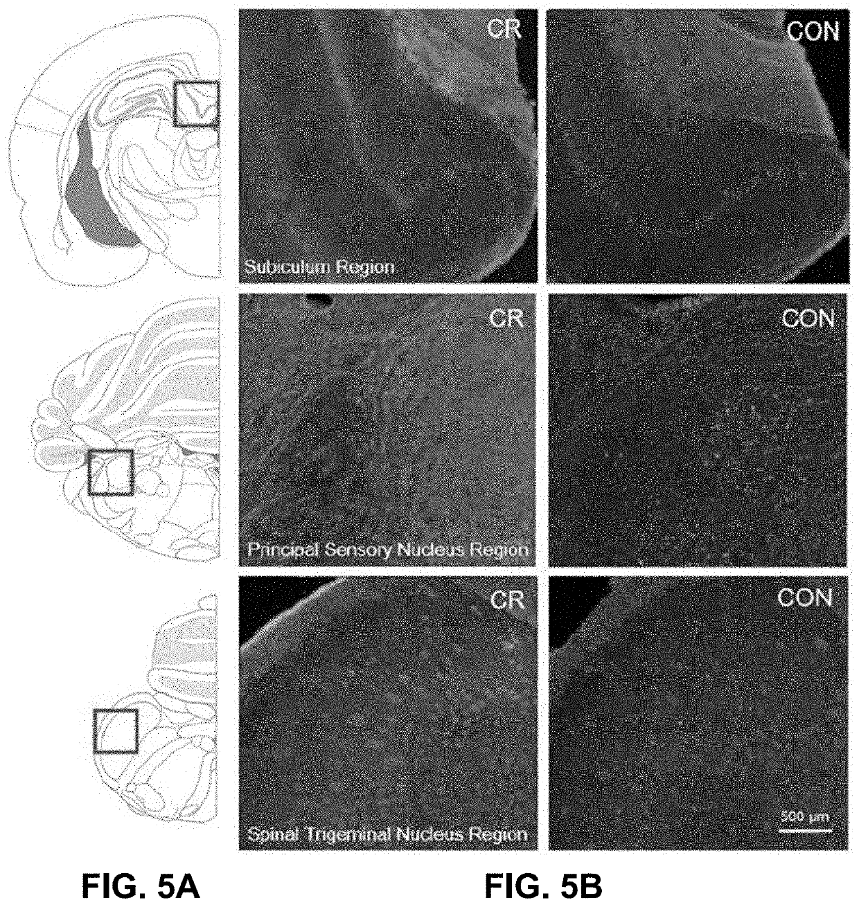 Generation of personalized neuroprotective and cardioprotective nutrition programs featuring caloric restriction