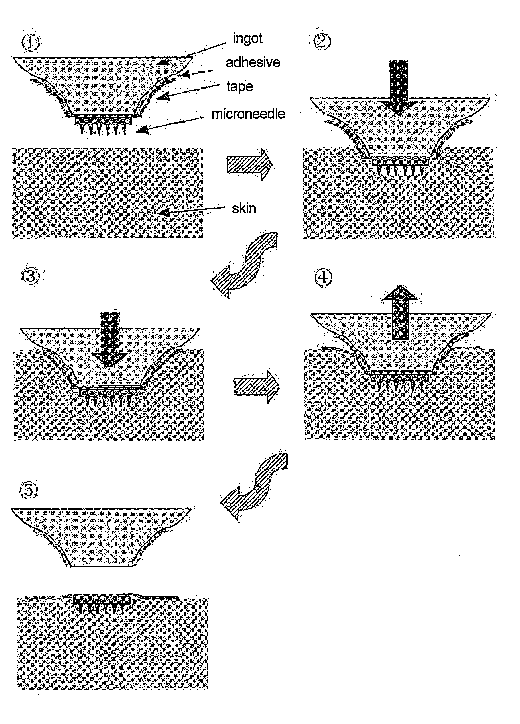 Adhesive patching aid for microneedle adhesive skin patch