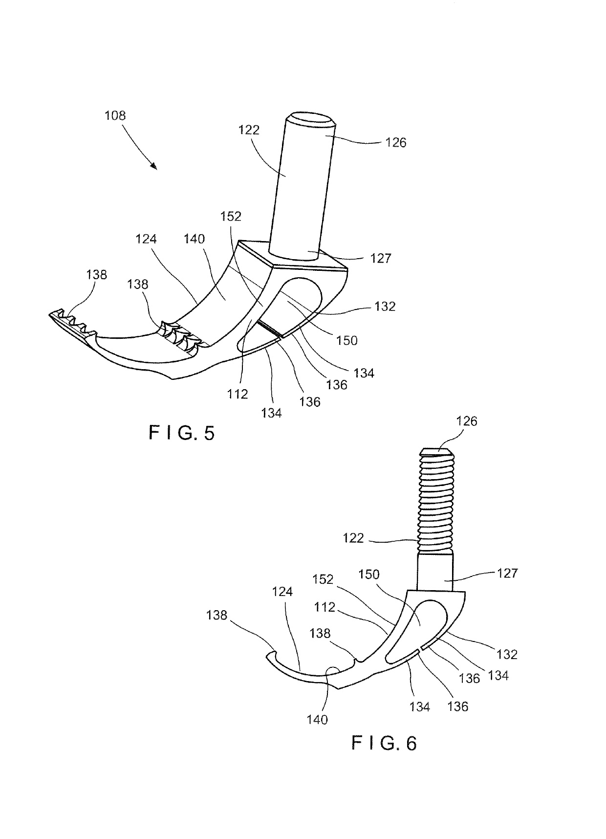 Bone Fracture Fixation Clamp with Bone Remodeling Adaptability