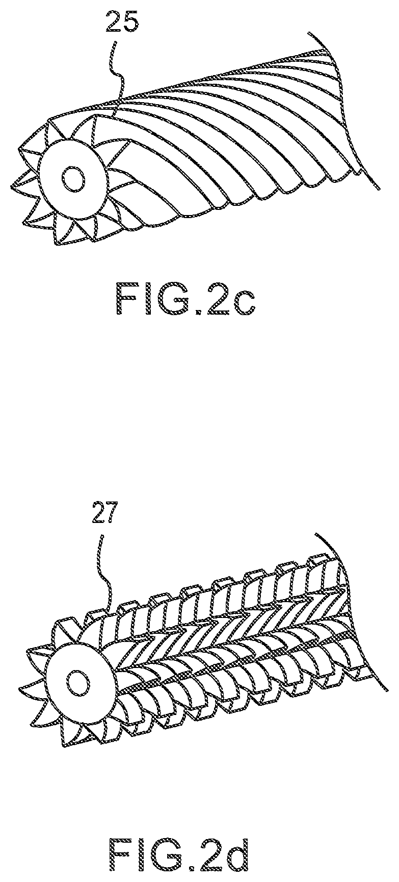 Catheter design for use in treating pleural diseases