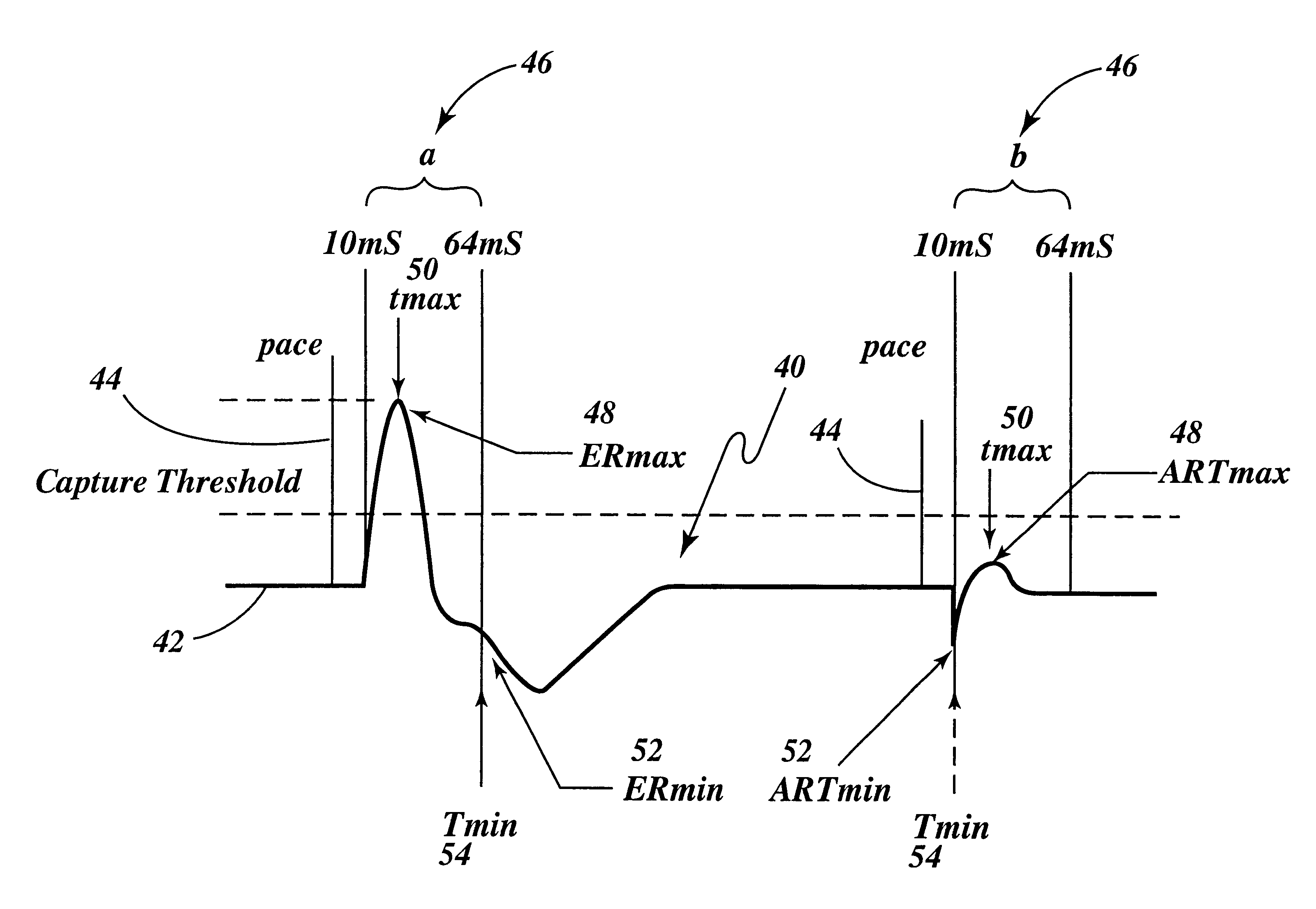 Cardiac management device with capability of noise detection in automatic capture verification