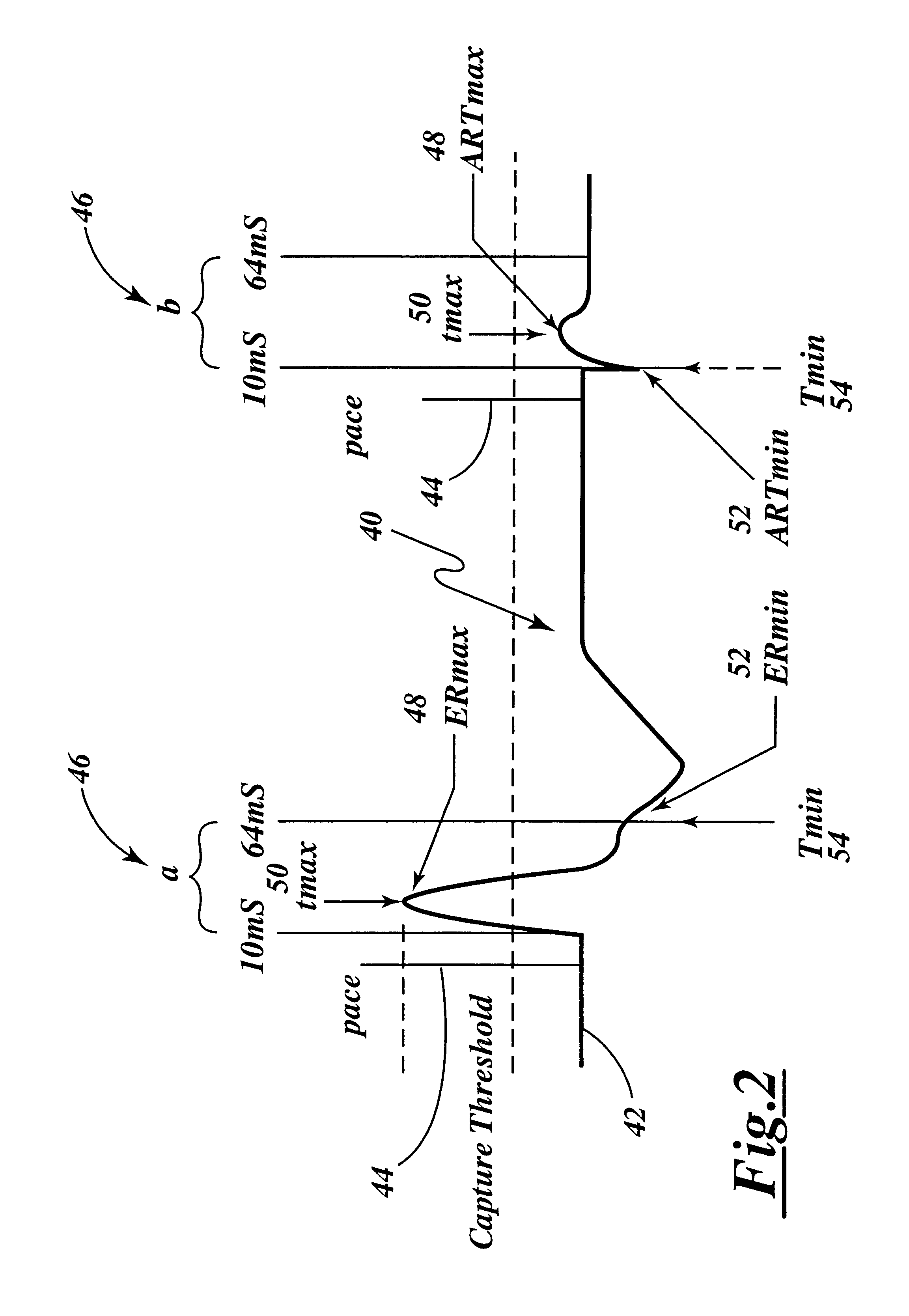 Cardiac management device with capability of noise detection in automatic capture verification