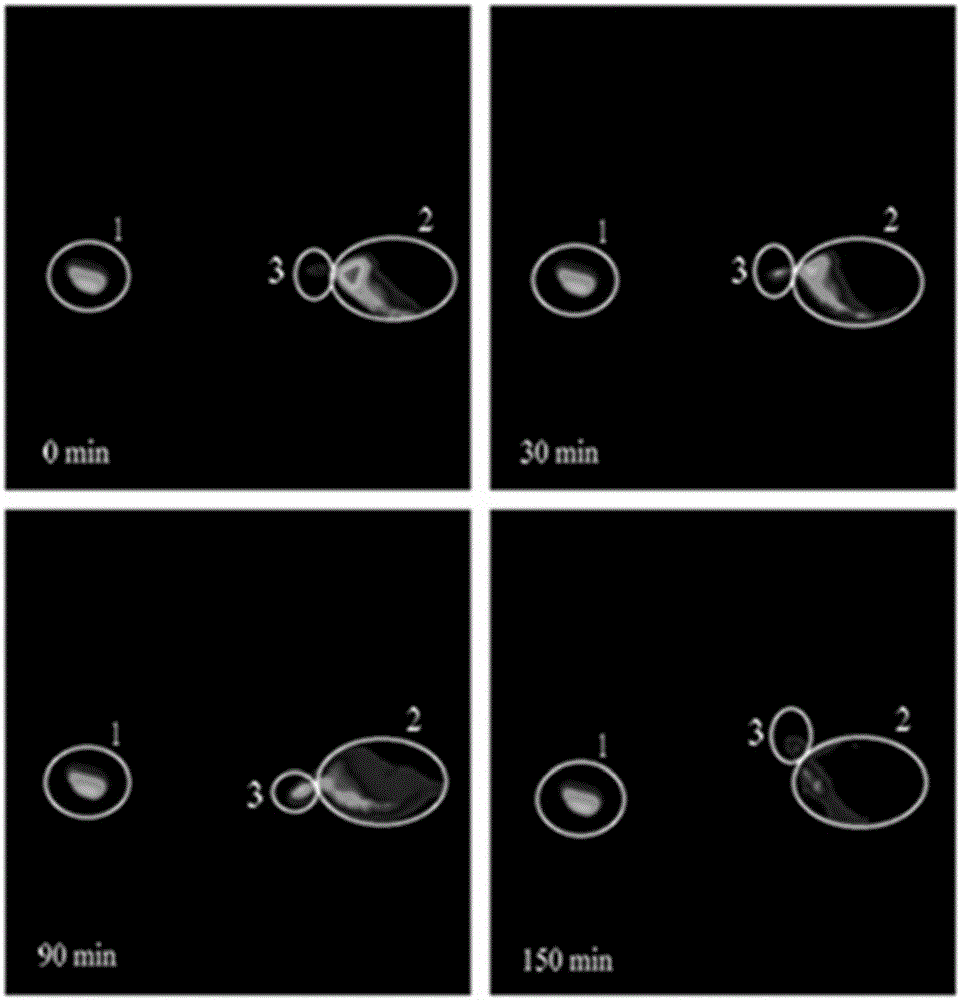 Tetrandrine liquid crystal nanoparticle preparation for eyes and preparation method thereof