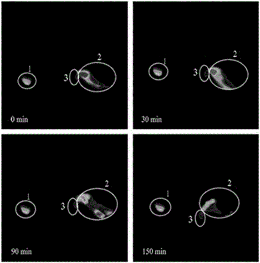 Tetrandrine liquid crystal nanoparticle preparation for eyes and preparation method thereof