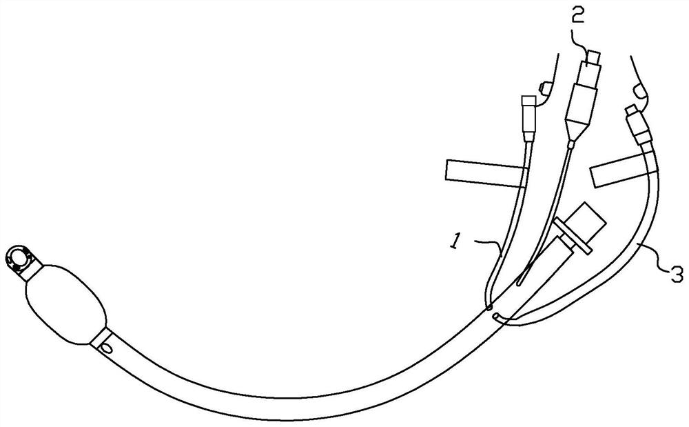 Airway management method, airway management system and ventilator during tracheal intubation ventilation