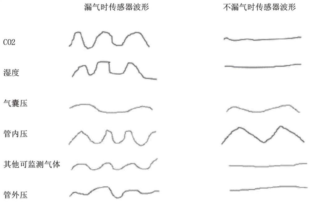 Airway management method, airway management system and ventilator during tracheal intubation ventilation