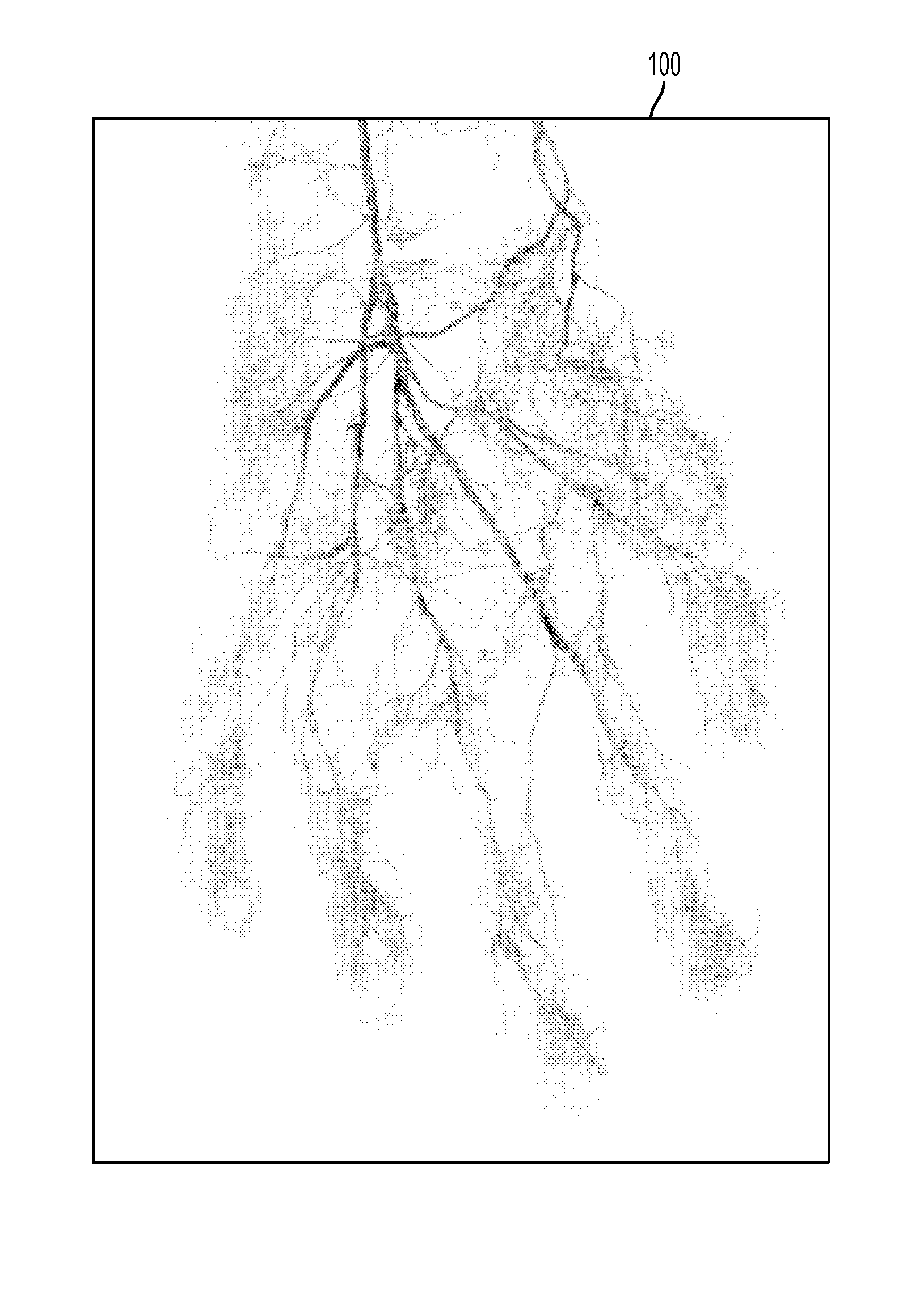 Processing a video for vascular pattern detection and cardiac function analysis