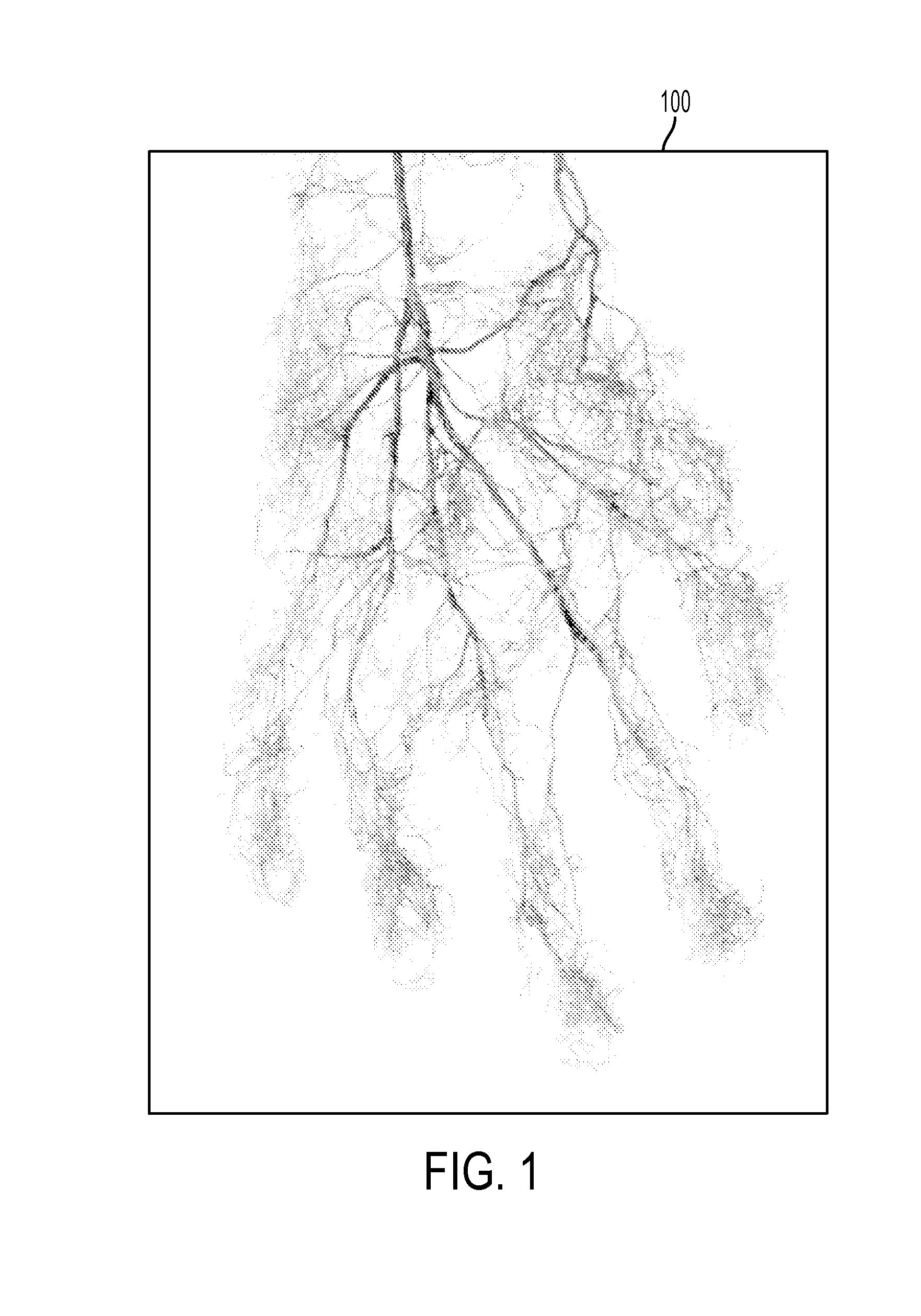 Processing a video for vascular pattern detection and cardiac function analysis