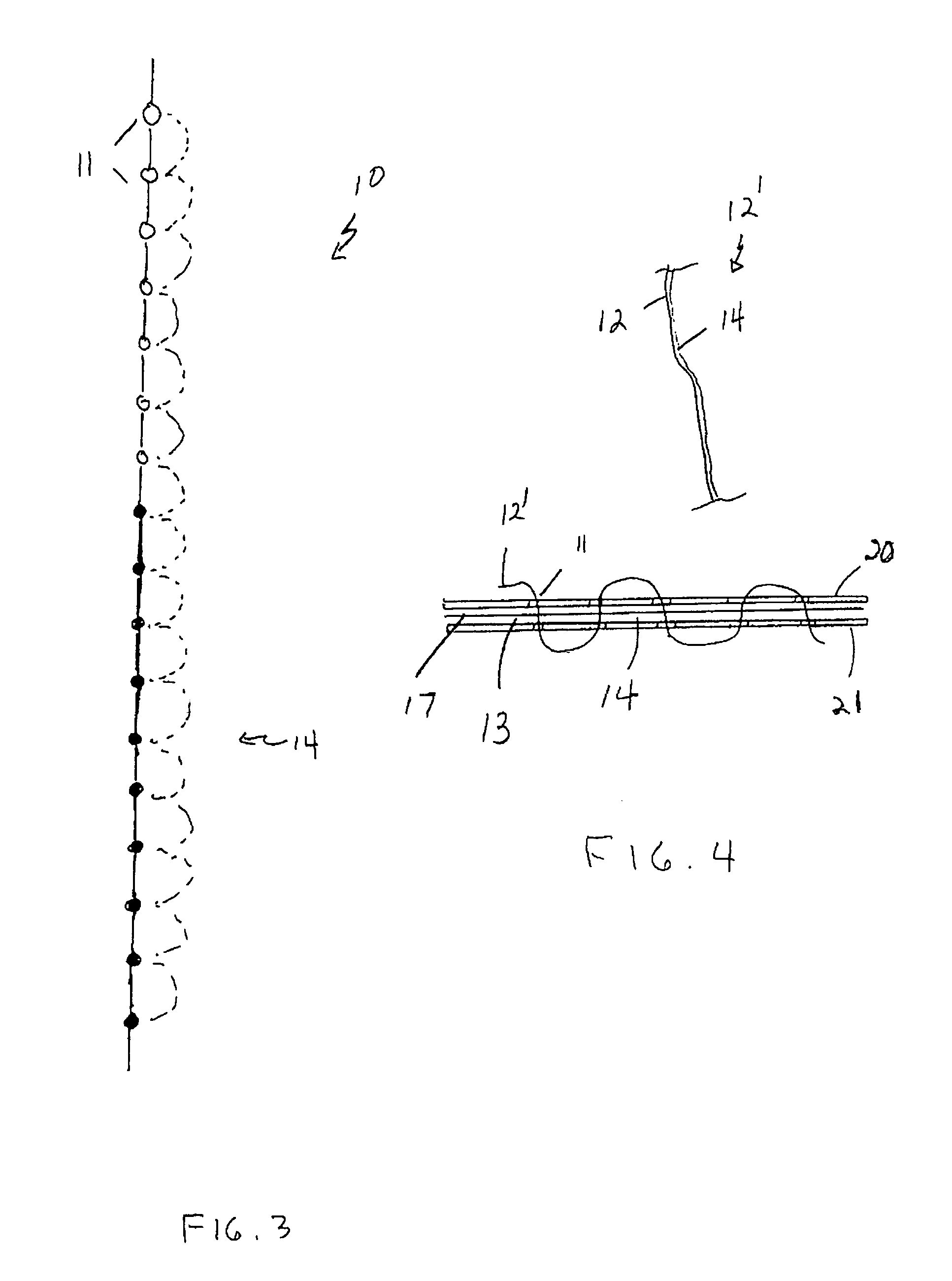 Adhesive thread system