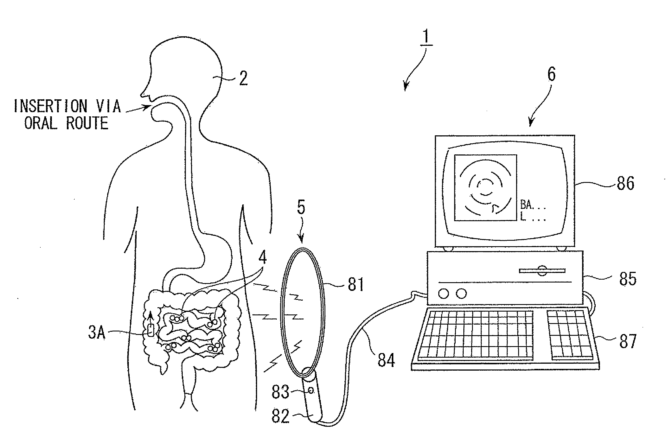 In-vivo information acquisition apparatus and in-vivo information acquisition apparatus system