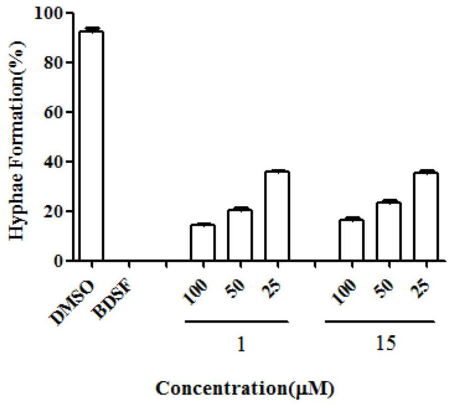 A kind of 2-alkylaminoquinoline compound for preventing and treating Candida albicans and its preparation method and application