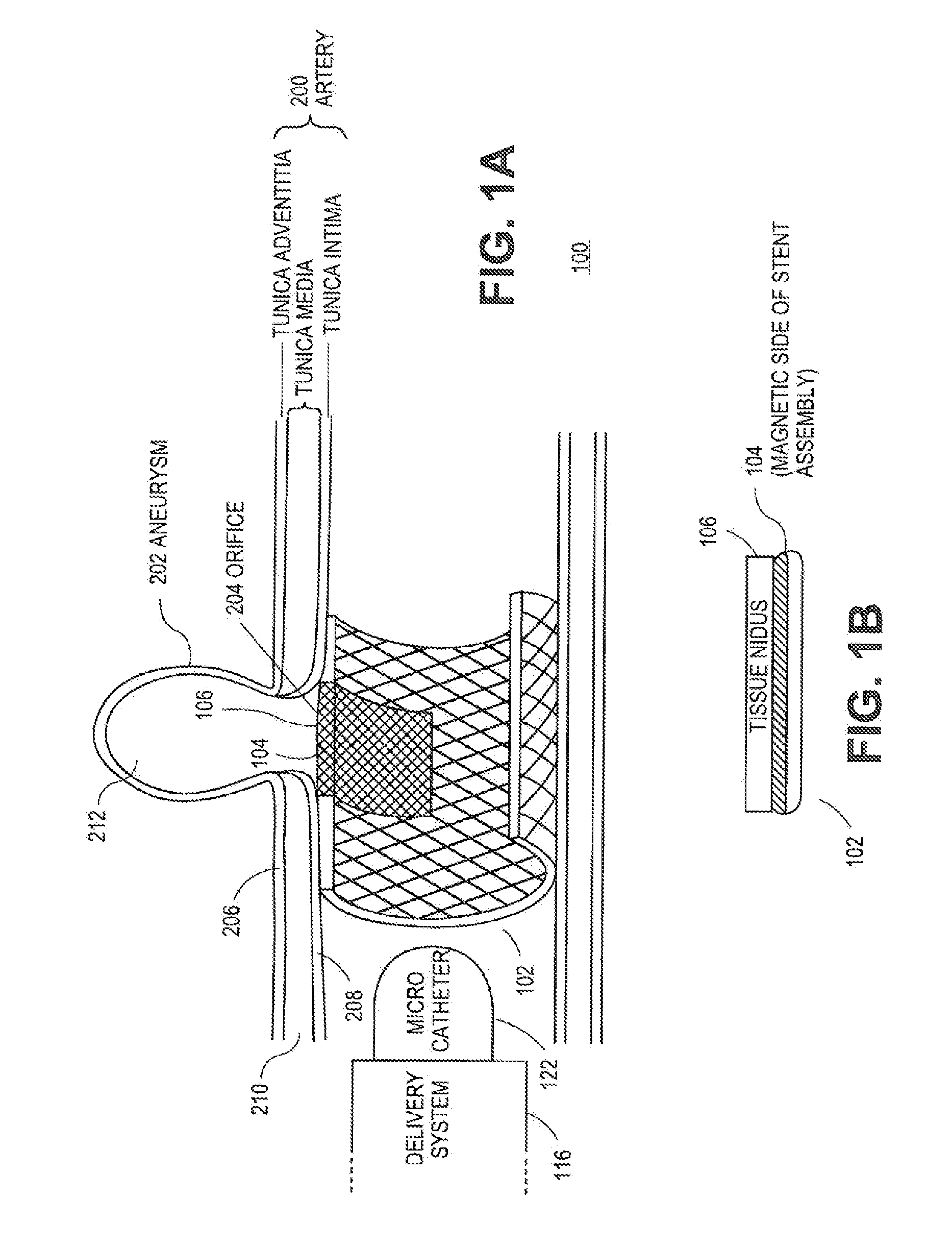 Systems and Methods for Magnetized Stent Having Growth-Promoting Properties