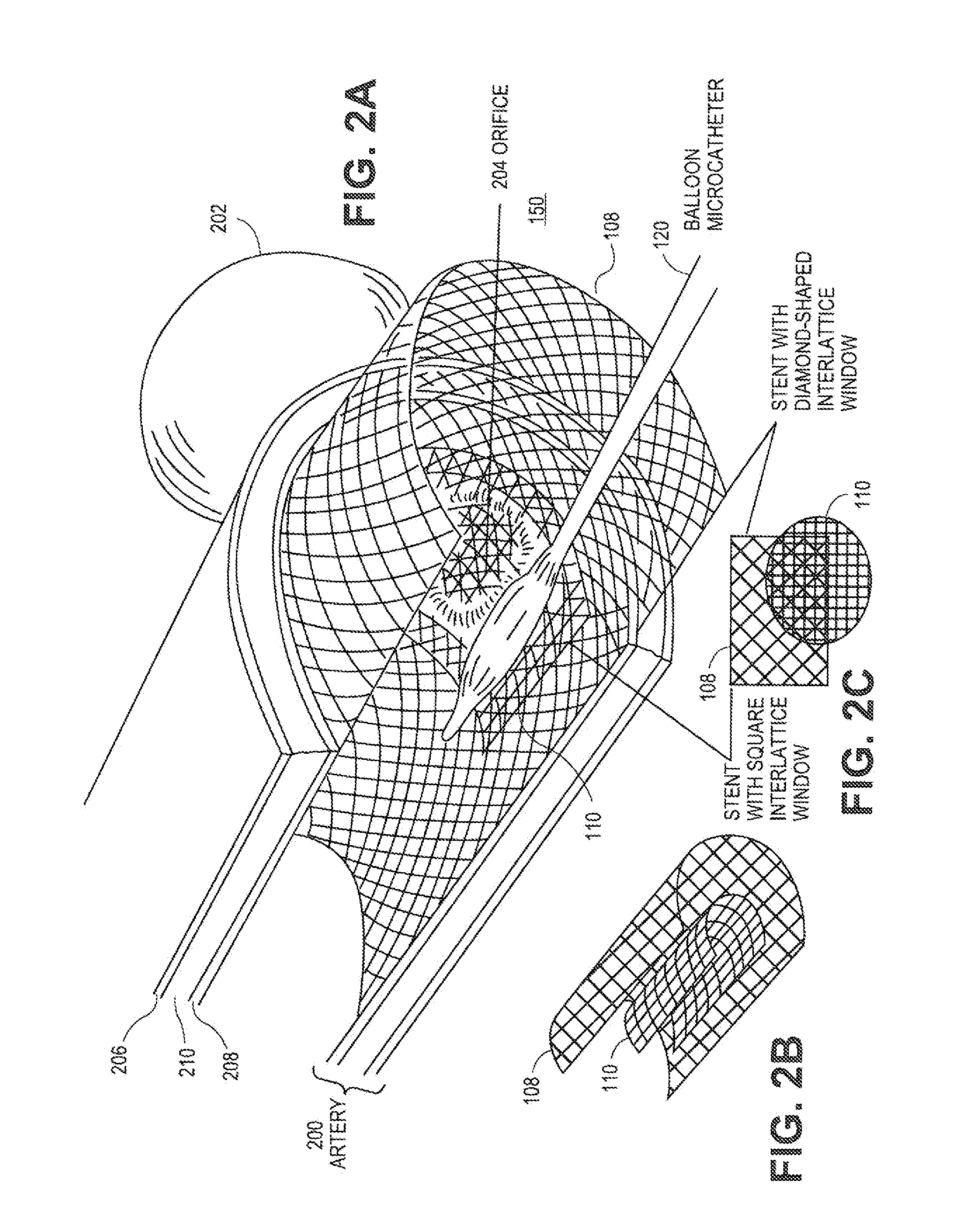 Systems and Methods for Magnetized Stent Having Growth-Promoting Properties