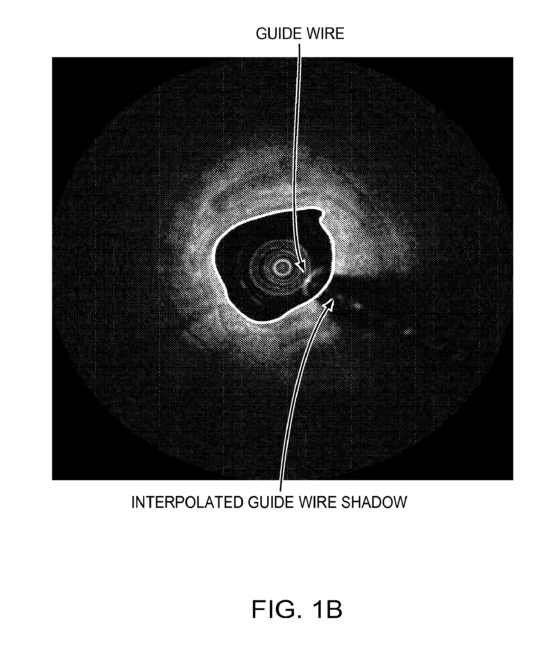 Lumen Morphology and Vascular Resistance Measurements Data Collection Systems, Apparatus and Methods