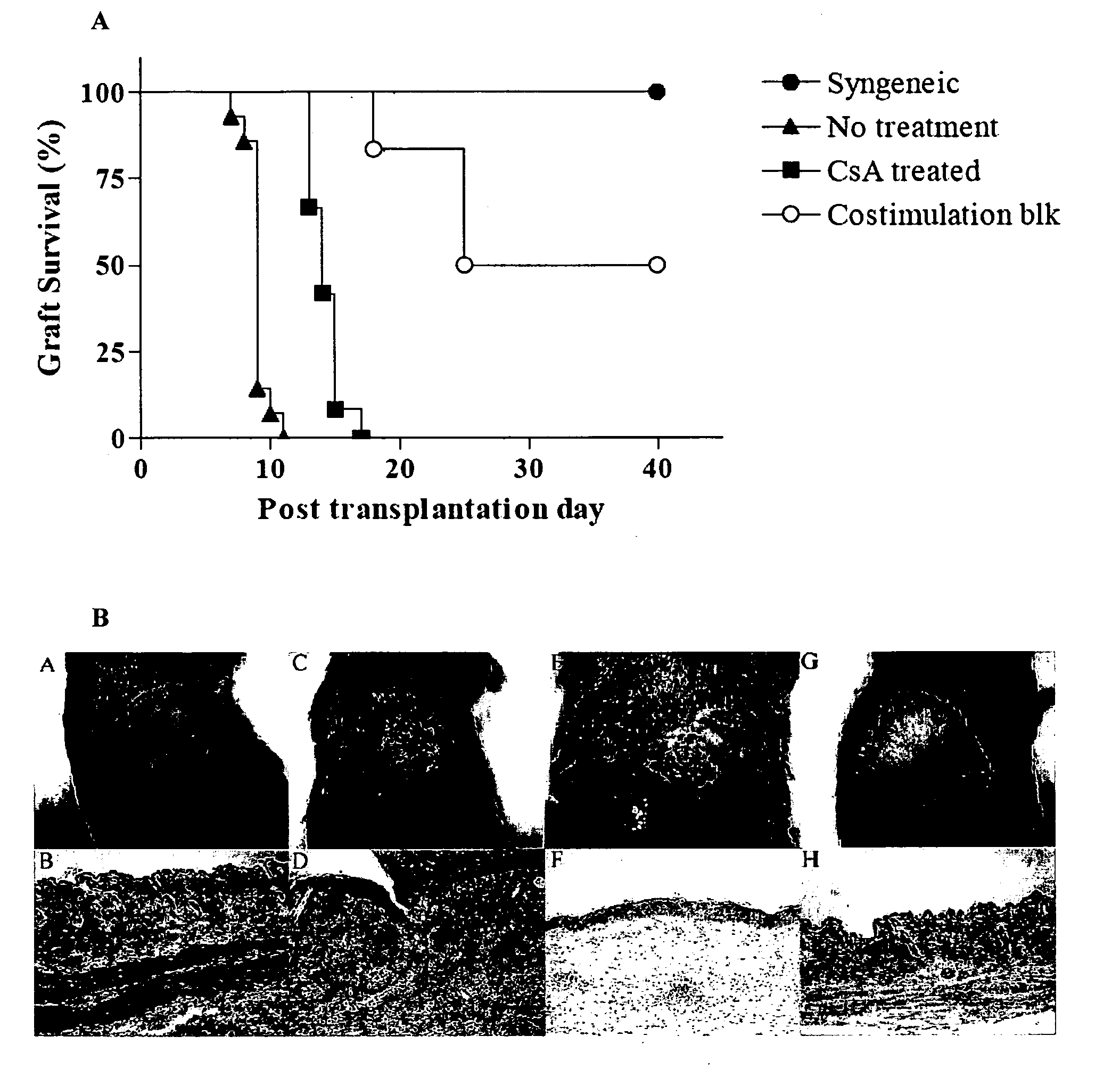 Systems and methods for monitoring immune responses and predicting outcomes in transplant recipients