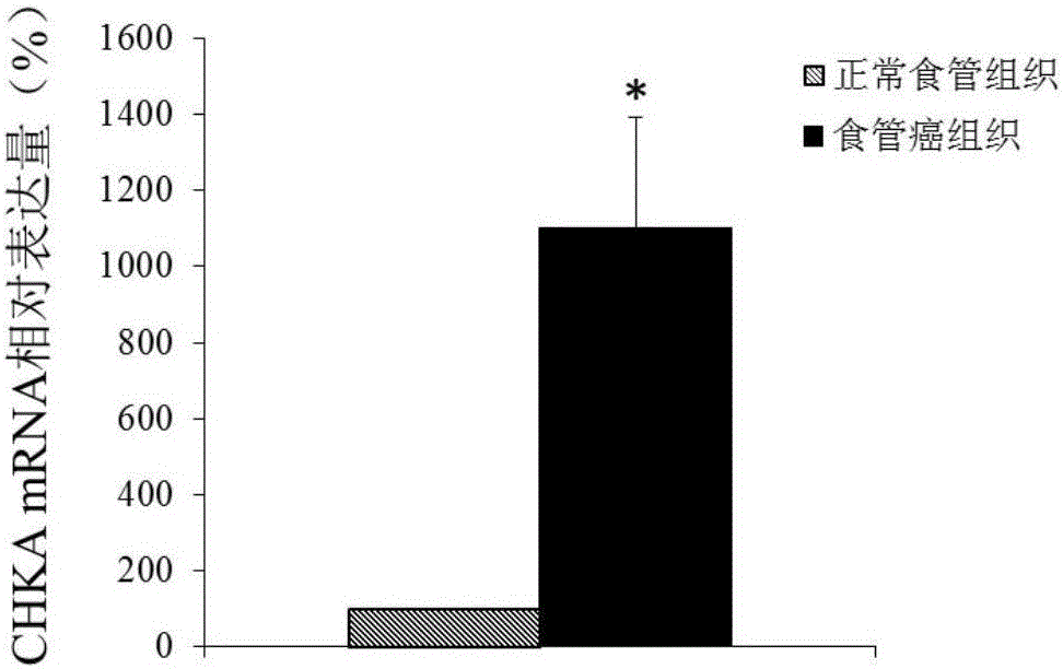 Application of CHKA gene to preparation of esophageal cancer diagnosis and treatment product