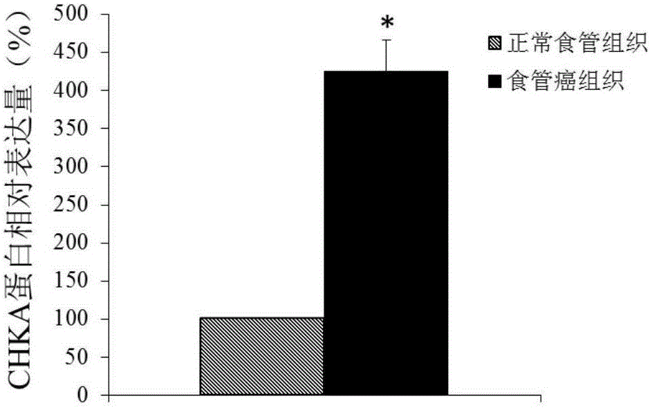 Application of CHKA gene to preparation of esophageal cancer diagnosis and treatment product