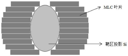 A method for optimizing collimator angle in volume rotation and intensity modulated radiotherapy planning