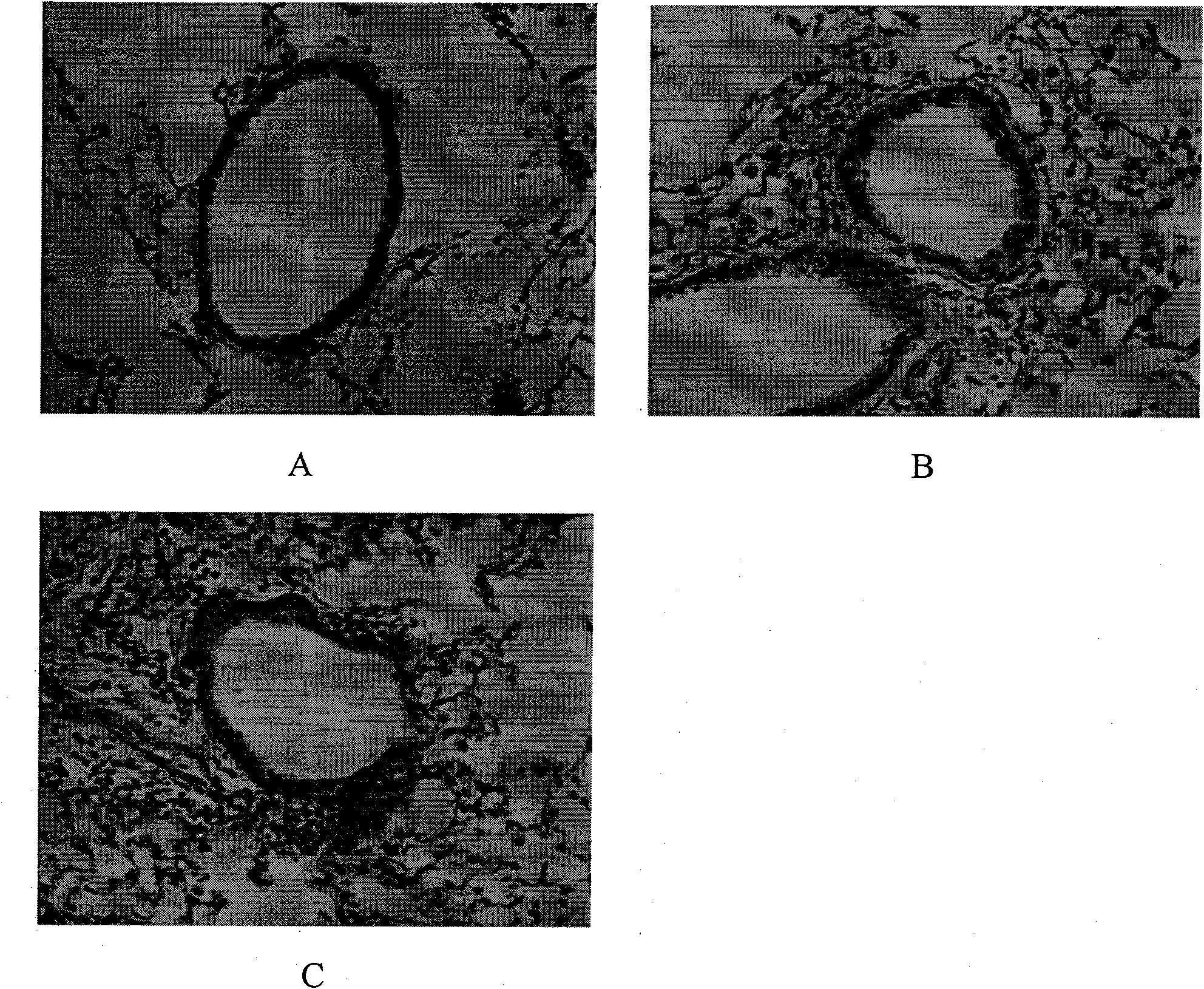 Method for establishing airway-free high-reactivity eosinophilic granulocyte airway inflammatory mouse model