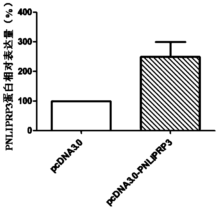 Application of pnliprp3 gene and its expression product in the diagnosis and treatment of squamous cell carcinoma of the tongue