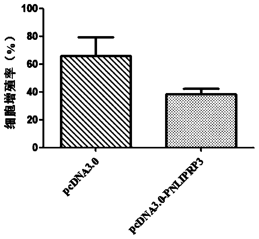 Application of pnliprp3 gene and its expression product in the diagnosis and treatment of squamous cell carcinoma of the tongue