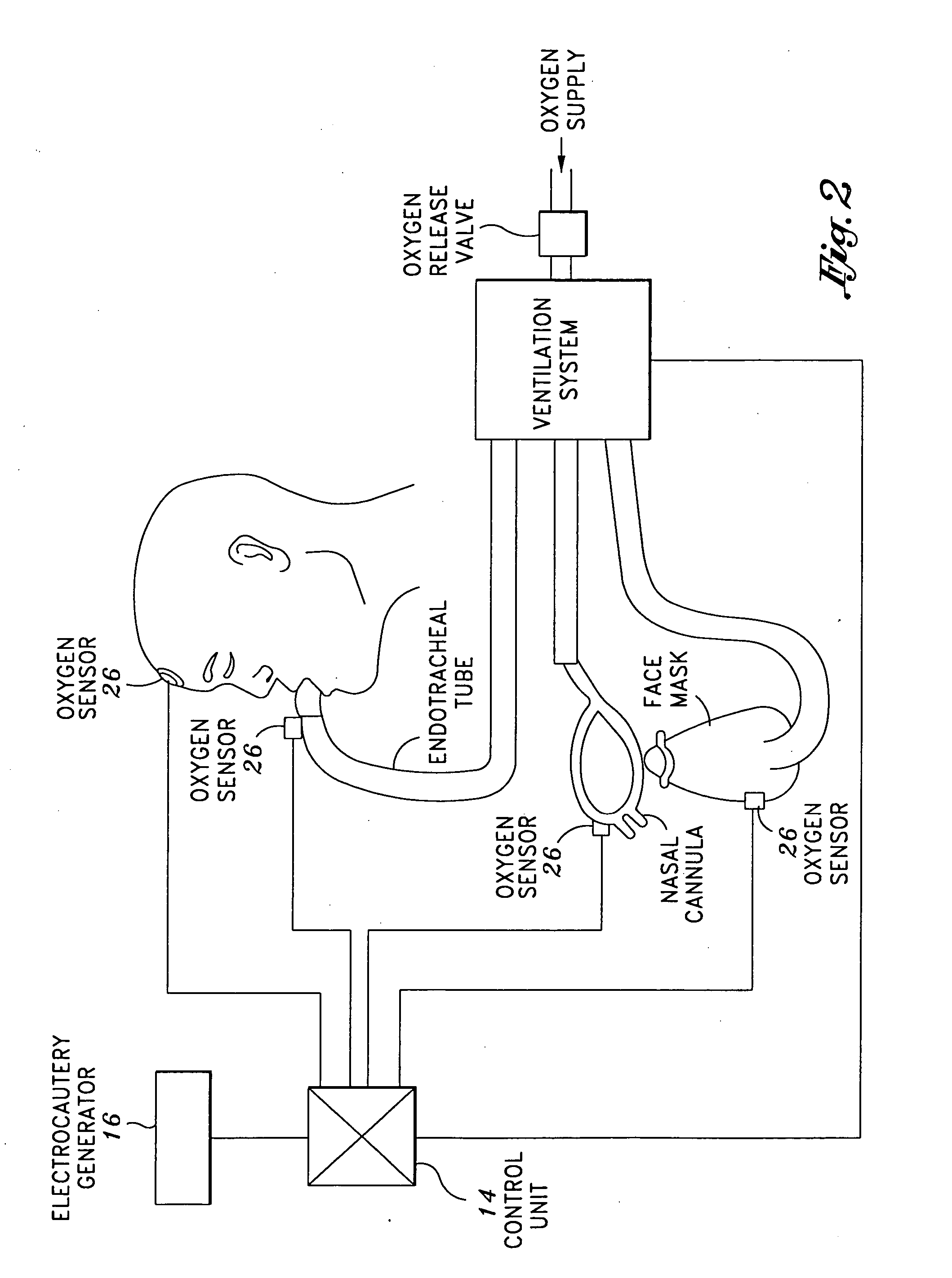 Oxygen sensory system that minimizes outbreak of operating room fires