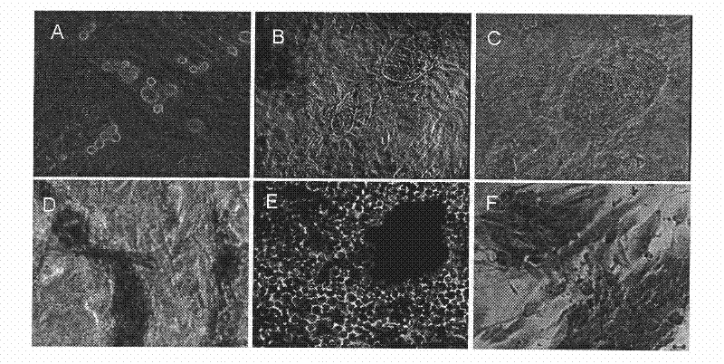 A kind of in vitro isolation and culture method of goat male reproductive stem cells