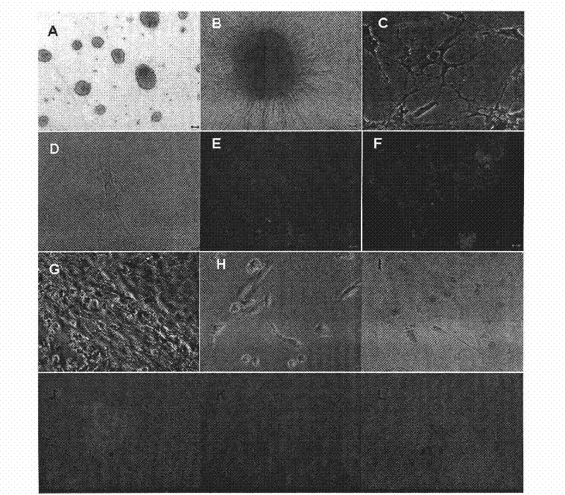 A kind of in vitro isolation and culture method of goat male reproductive stem cells