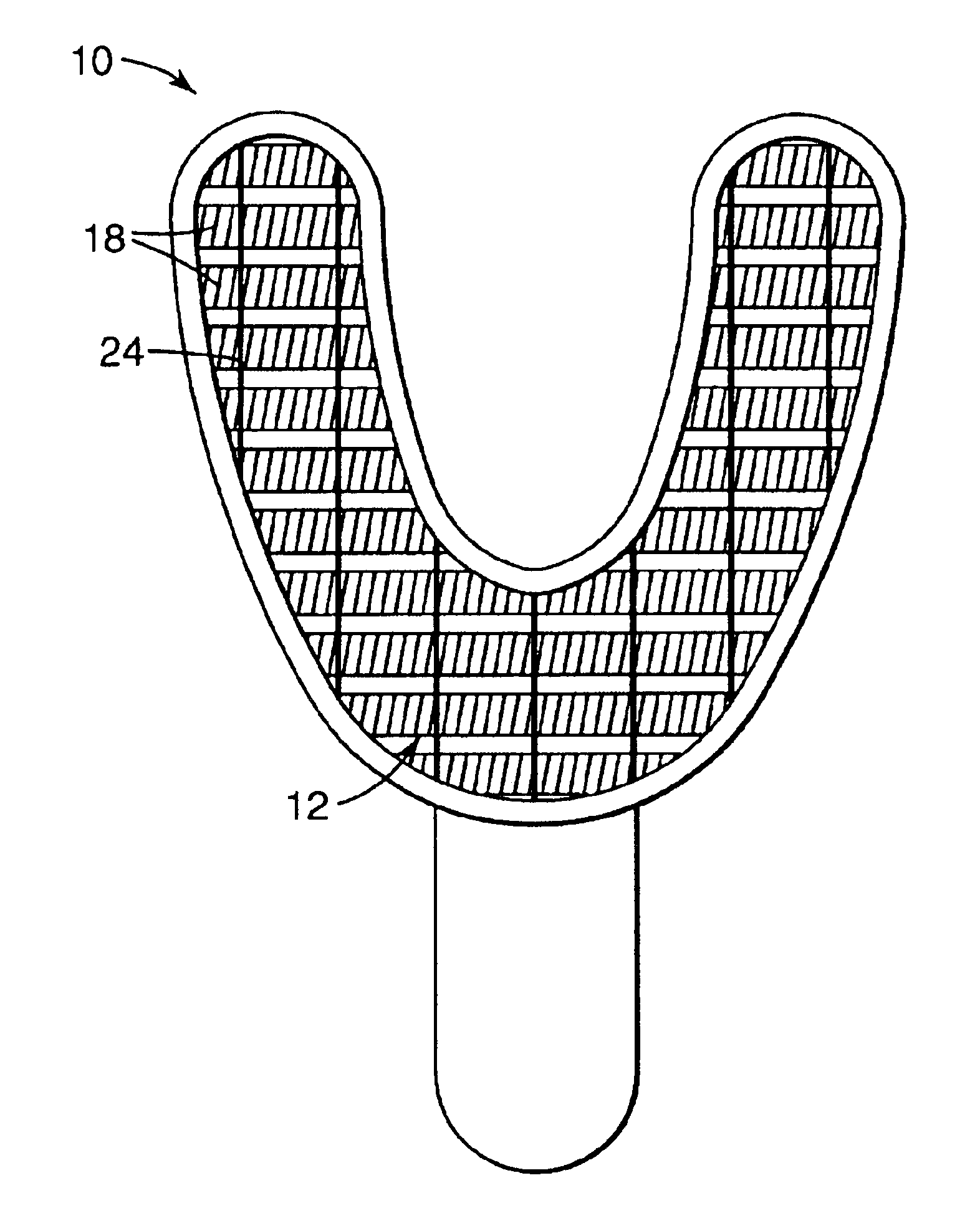 Dental impression tray with impression material retainer