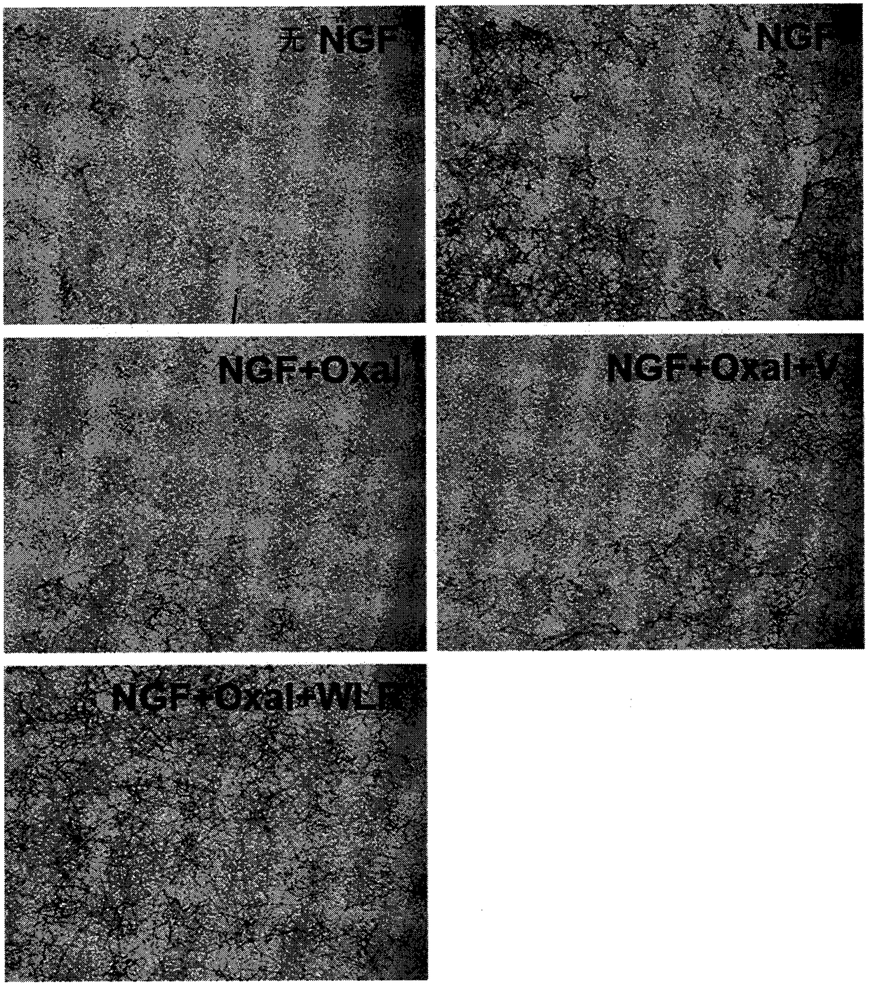 Composition, containing lithospermi radix extract as active ingredient, for preventing, alleviating, or treating peripheral neuropathy