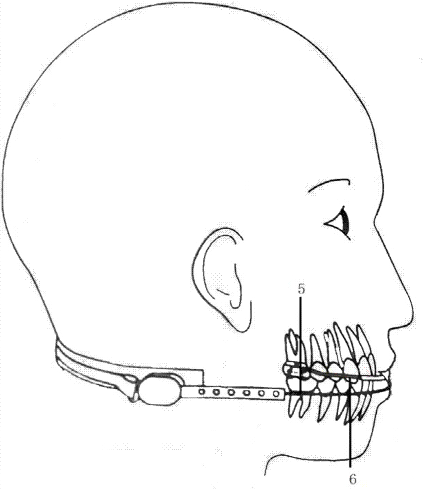 Orthodontic neckband for measuring and controlling tension