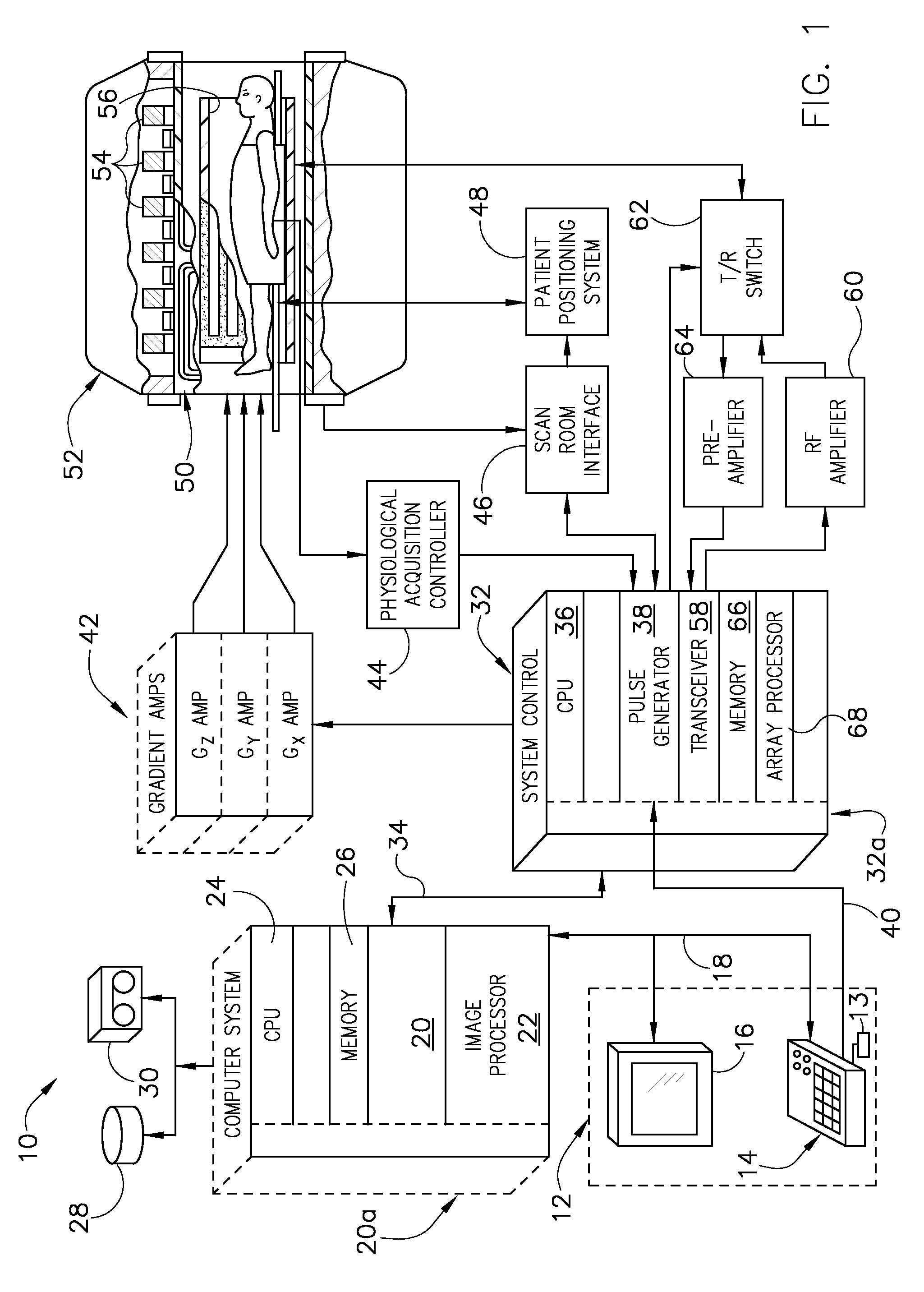 Method and apparatus for correcting distortion in mr images caused by metallic implants