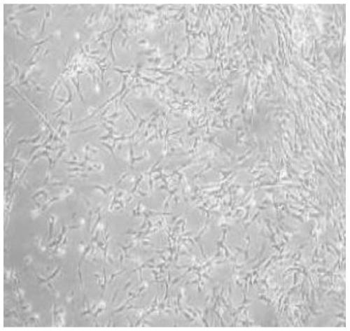 Construction method of human umbilical cord mesenchymal stem cell (UCMSCS) seed bank and detection platform thereof