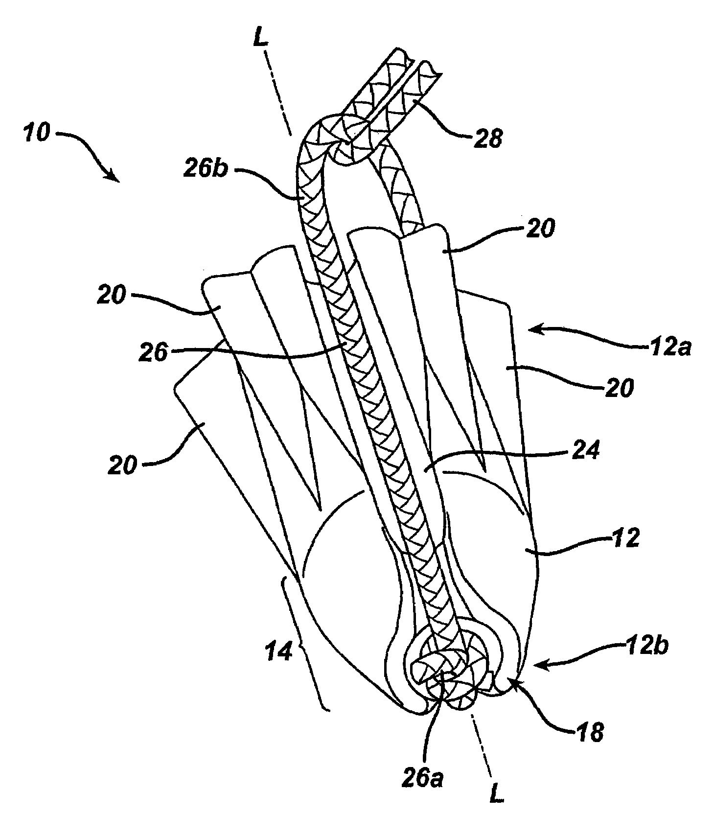 Suture loop anchor