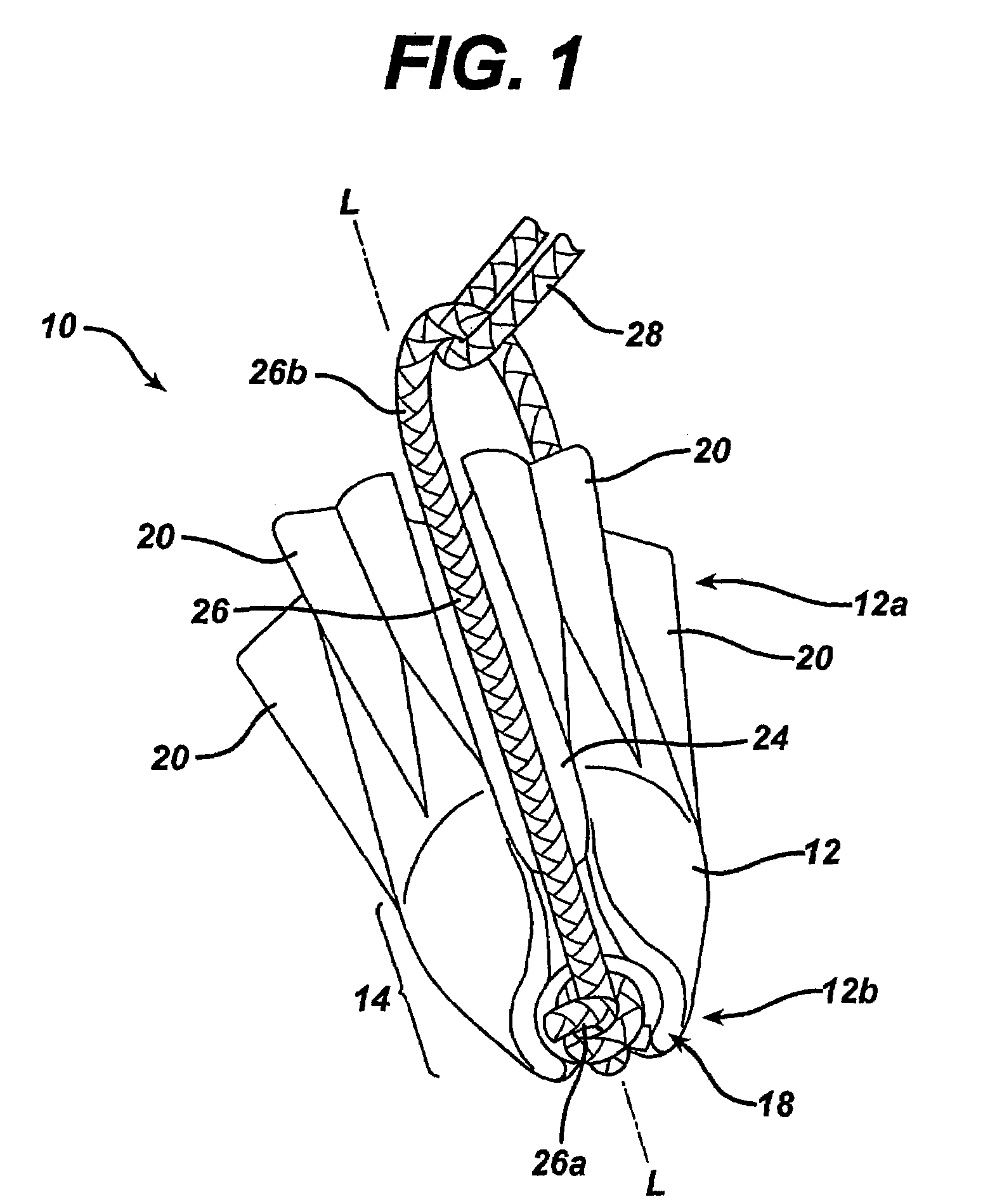 Suture loop anchor