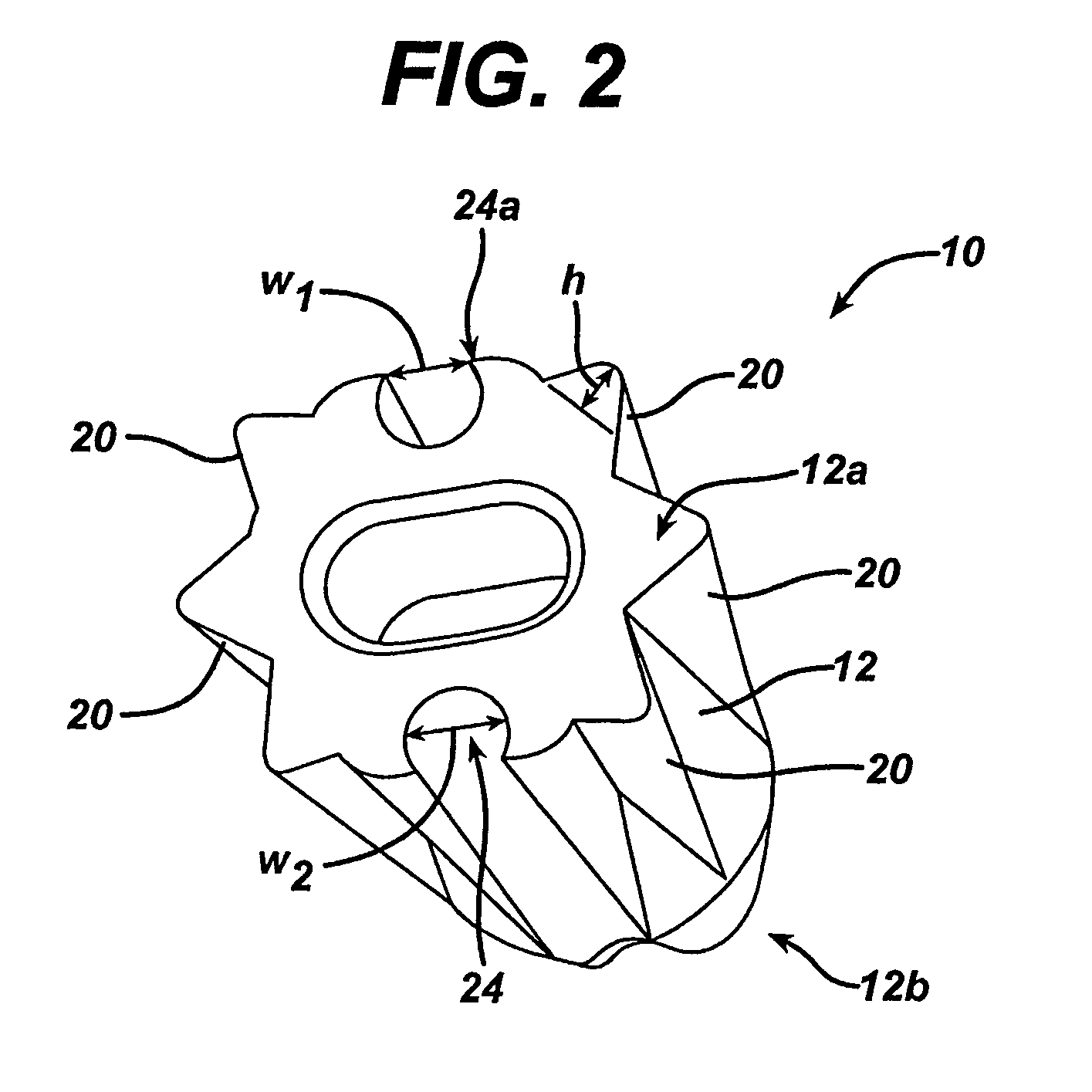 Suture loop anchor