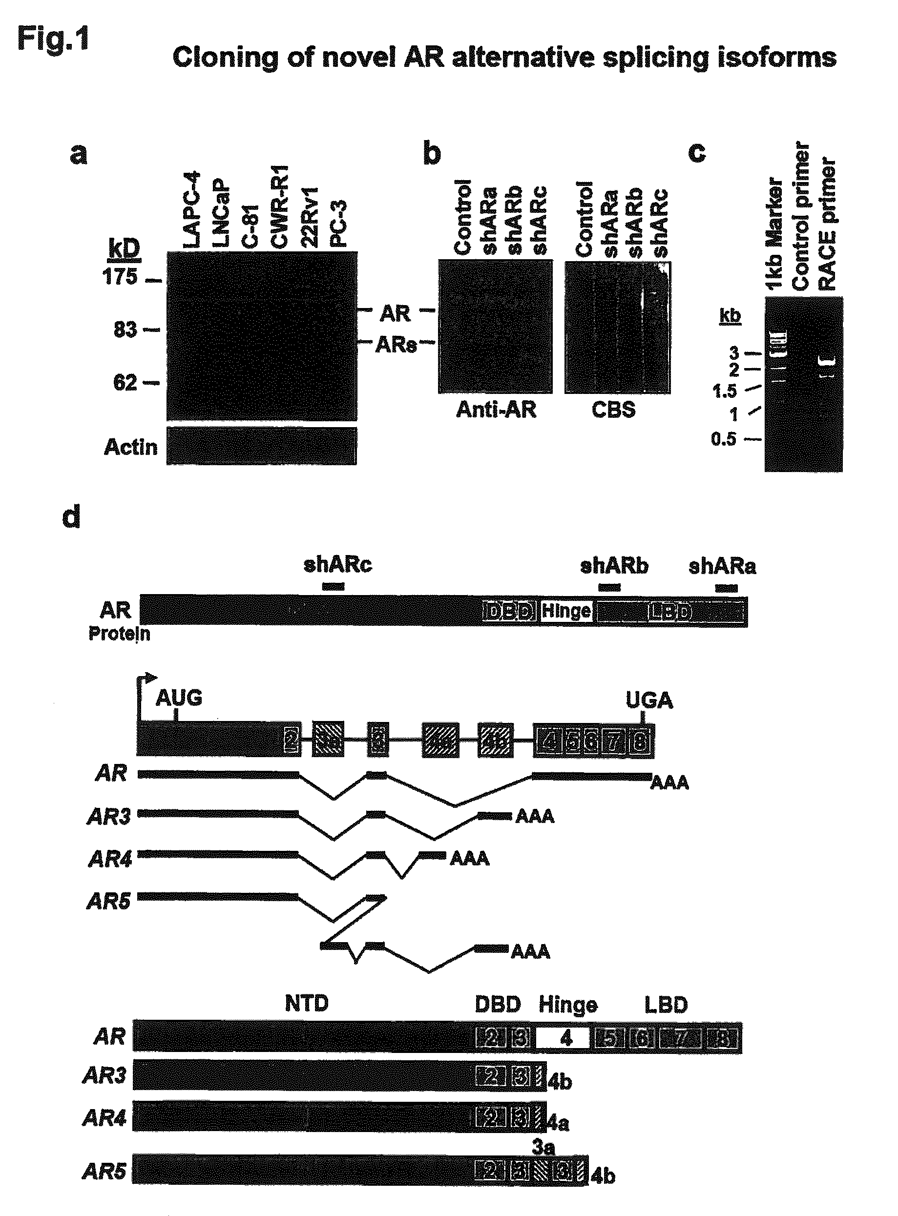 Human androgen receptor alternative splice variants as biomarkers and therapeutic targets