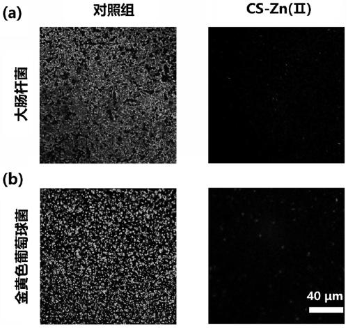 Antibacterial biofilm composite microneedle and application thereof