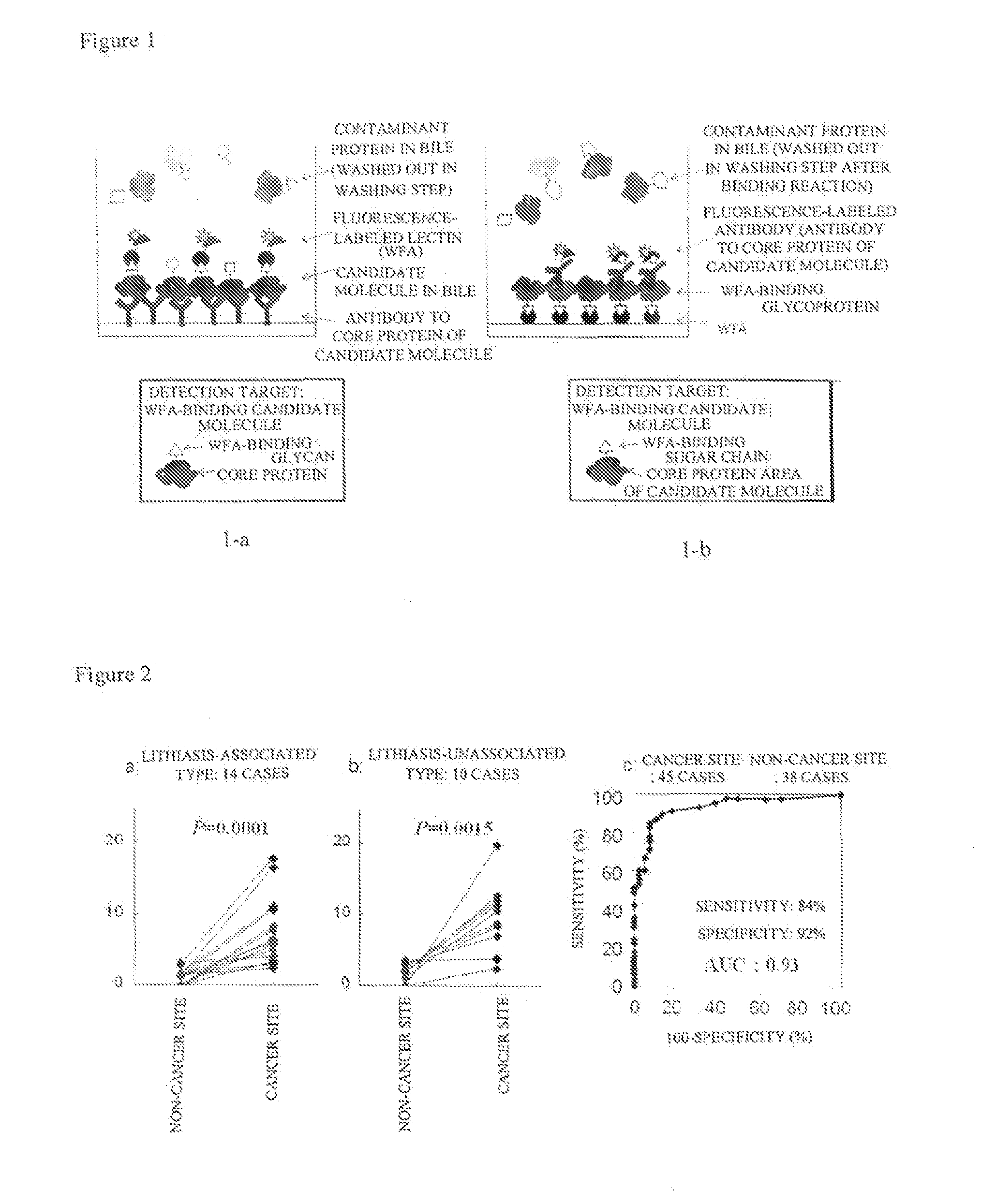 Method for detecting and distinguishing intrahepatic cholangiocarcinoma