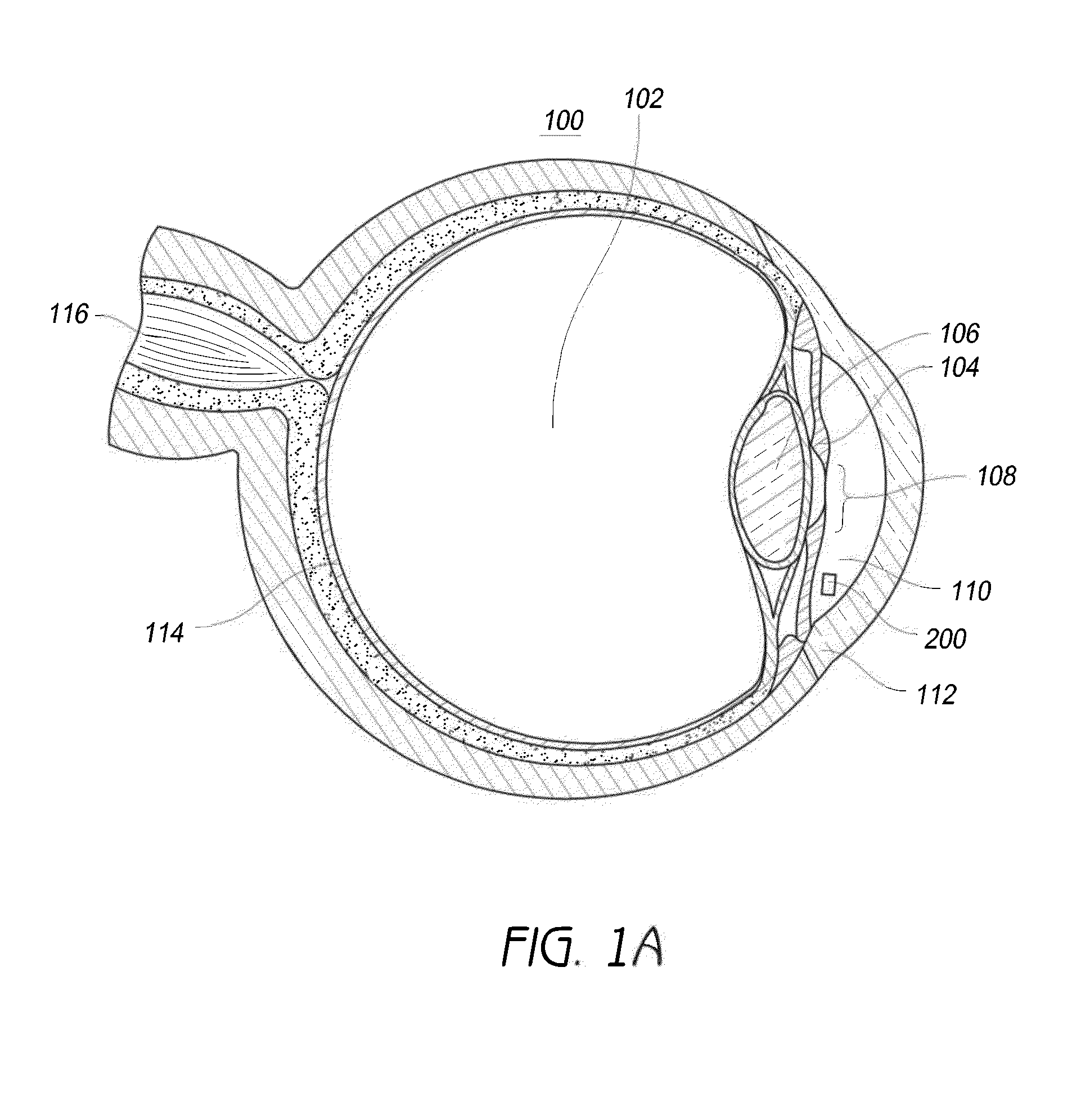 Intraocular physiological sensor