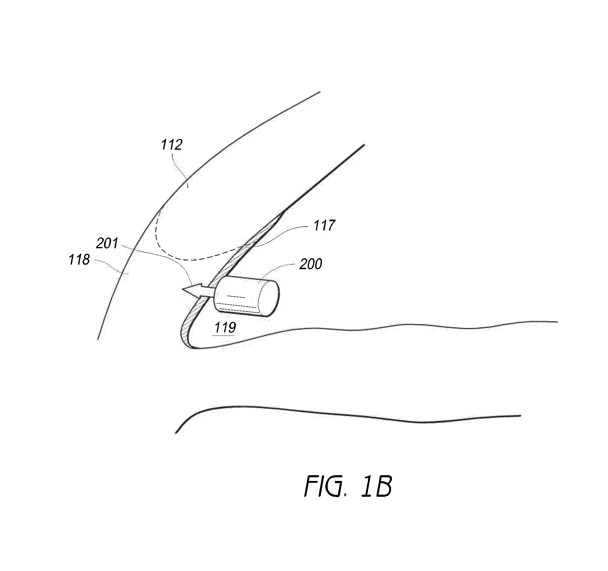 Intraocular physiological sensor