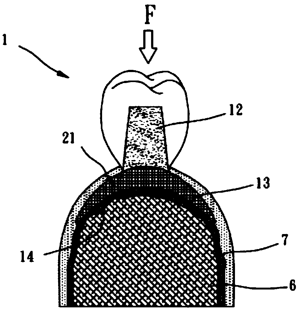 Artificial tooth body having vertical type bone beam structure