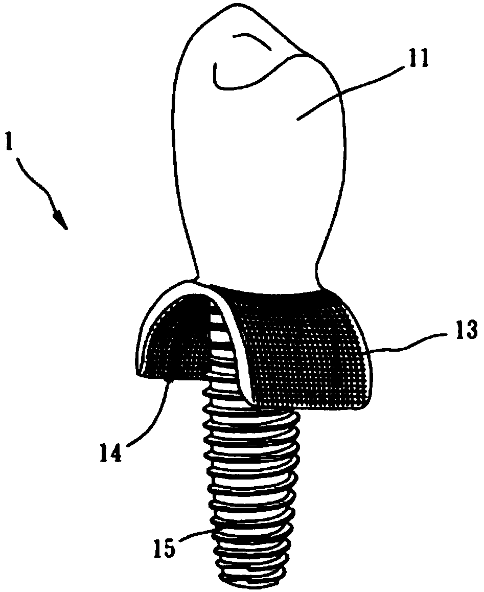 Artificial tooth body having vertical type bone beam structure