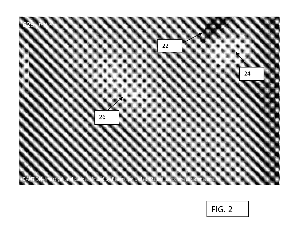 Locating and analyzing perforator flaps for plastic and reconstructive surgery